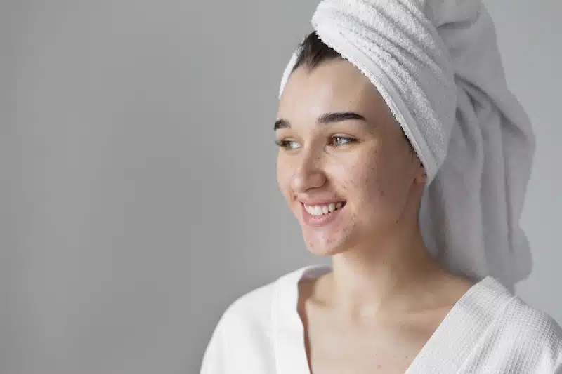 manchas en el rostro productos aclarantes